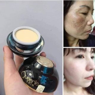 KEM FACE NÁM CAO CẤP QUEENIE SKIN 35g( tặng 1 serum dịch yến trong từng hộp kem)
