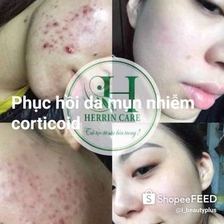 Trị mụn 24h Herrin Care - Tinh chất tái tạo 24h