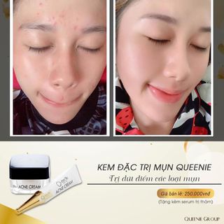 KEM ĐẶC TRỊ MỤN QUEENIE SKIN