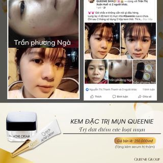 KEM ĐẶC TRỊ MỤN QUEENIE SKIN
