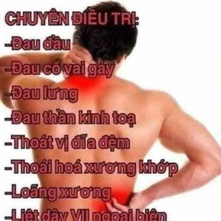 Viêm thấp khớp nặng