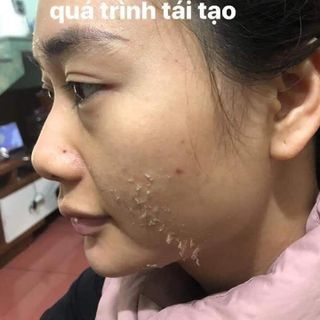 VI KIM TẢO BIỂN TẾ BÀO GỐC TRANNA PEEL Hàn Quốc - đầy đủ giấy tờ