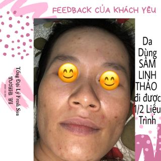 Sâm Linh Thảo Cao Cấp