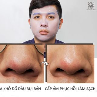 Mặt nạ làm sạch sâu Beauty Player Đài Loan (Đen) - Hộp 5 miếng