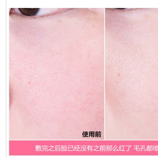 Mặt nạ Beauty Opinion ( Nội địa Trung/ Đài )