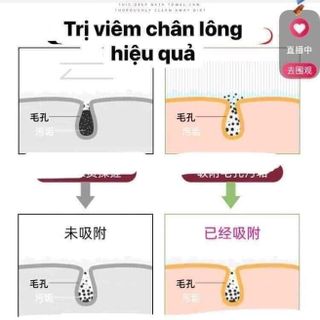 Cọ lưng silicon
