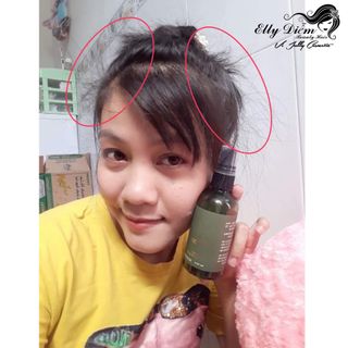 Tinh Dầu Bưởi Vi Jully Trị Rụng Tóc