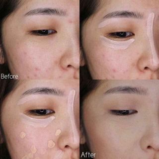 Kem che khuyết điểm 2 đầu