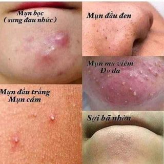 Cao Tinh nghệ sữa ong chúa thảo mộc 37