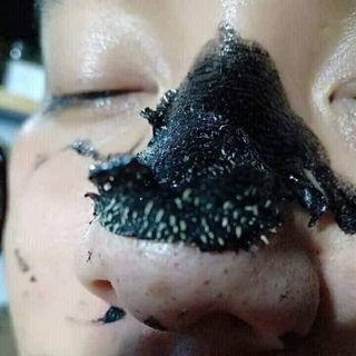Mặt Nạ Lột Mụn Black Mask