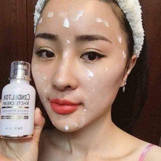 Kem truyền trắng cindeltox