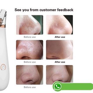 Máy hút mụn đầu đen 3 đầu thay thế Black Head Detector giá sỉ​, giá bán buôn