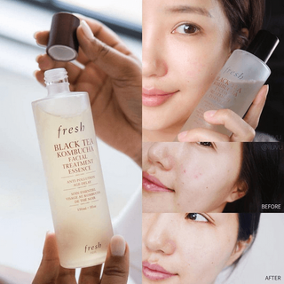 Nước thần Fresh Black Tea Kombucha Facial Treatment Essence 250ml
