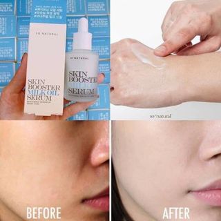 Serum kích trắng da trị mụn thâm nám tàn nhang
