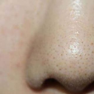 Collagen plus vite