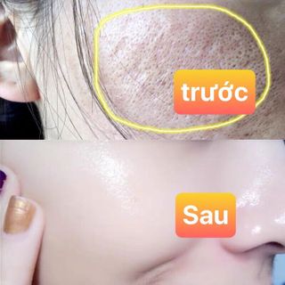 Serum 24k