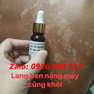 Điều trị dứt điểm lang ben, hắc lào, vảy nến...