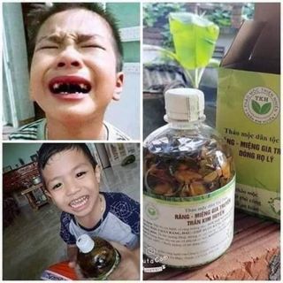 Đặc trị răng miệng, hôi miệng, sâu răng