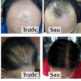 Dầu gội Thảo dược Thanh Mộc Hương