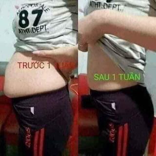 Kem tan mỡ phù thuỷ đỏ Thanh Mộc Hương