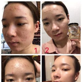 Mặt nạ collagen nhụy hoa nghệ tây tươi