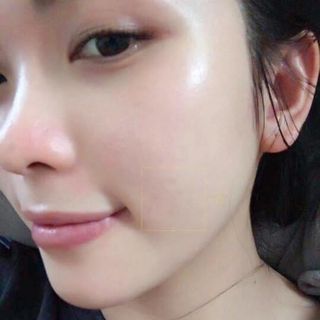 Buôn sỉ chấm tàn nhang - sẹo rỗ - đồi mồi