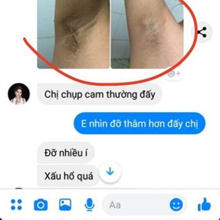 trị thâm khử mùi nách bẹn mông bikini