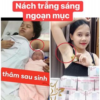 trị thâm khử mùi nách bẹn mông bikini