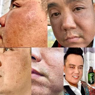 TÁI TẠO DA NHÂN SÂM MQ SKIN