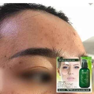 TÁI TẠO DA NHÂN SÂM MQ SKIN