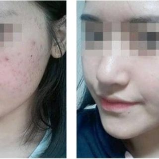Máy rửa mặt thông minh DOKAR