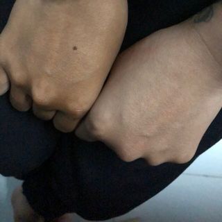 Xịt truyền trắng nellyp