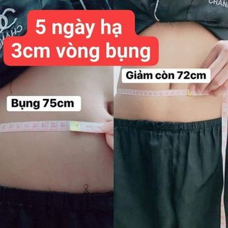 Cao hủy mỡ nhỏ cuống rốn