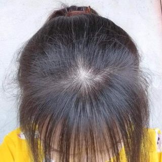 Xịt bưởi kích thích mọc tóc,trị hói đầu