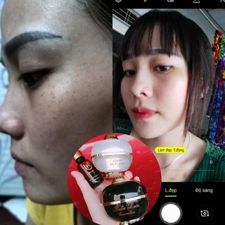Cao Đặc Trị Thâm Nám.