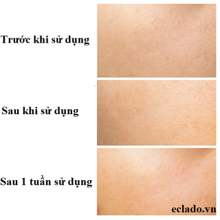 Eclado - Tinh chất trắng da C.Brighten Serum