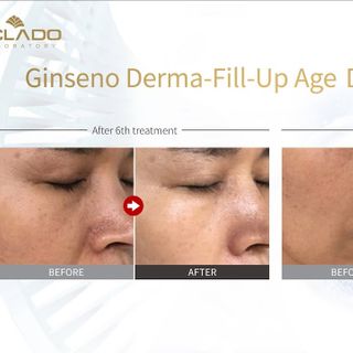NƯỚC HOA HỒNG SÂM NÚI Ginseno Triple Essential Toner