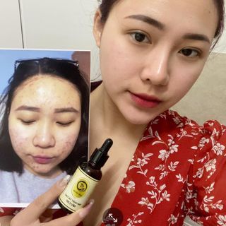 Bột Rửa Mặt Thảo Dược Hoàng Thiên Sâm