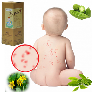 Lá tắm cho bé trị rôm sảy, mẩn ngứa Sài Đất, Mướp Đắng