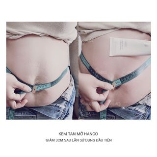 KEM TAN MỠ HANCO GIẢM NHANH 2-8cm