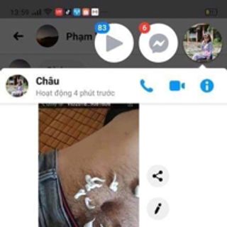 KEM TẨY LÔNG PERFECT CLEAN