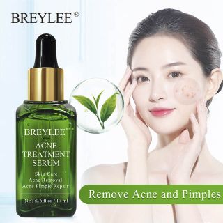 Serum trị mụn BREYLEE