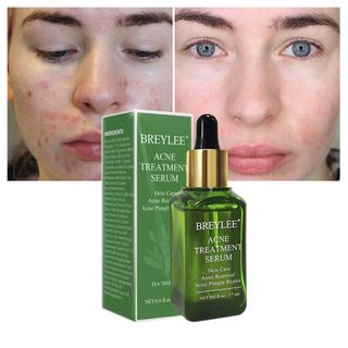 Serum trị mụn BREYLEE