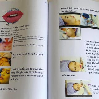GIÁO TRÌNH - TIÊM FILLER & BOTOX