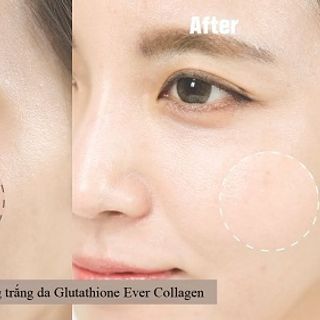 Viên Uống Trắng Da Angel’s Liquid Glutathione Ever Collagen loại 35 viên - 72 viên