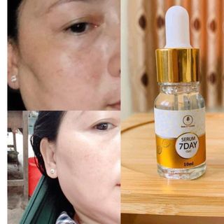 [THANH LÍ BAO CHECK] Serum trắng da 7 ngày olic, Huyết thanh truyền trắng olic