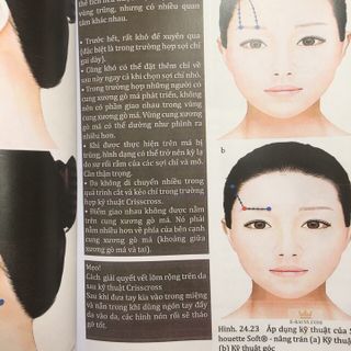 SÁCH - CĂNG DA MẶT BẰNG CHỈ Ở NGƯỜI CHÂU Á