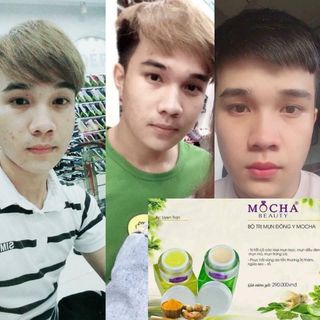 BỘ TRỊ MỤN MOCHA