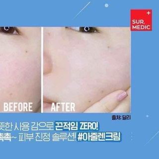 MẶT NẠ SERUM SUR. MEDIC HÀN QUỐC