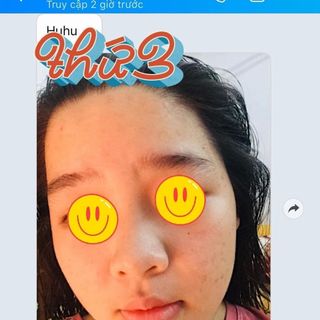 Dr Mai trị mụn nguyên chất